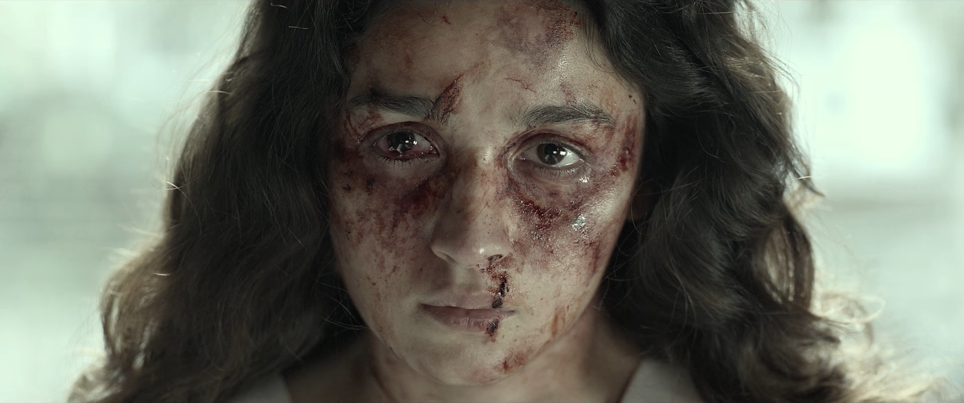 A tight close-up of a bruised, tearful face against a pale green-white background, with blood and skin texture clearly visible.